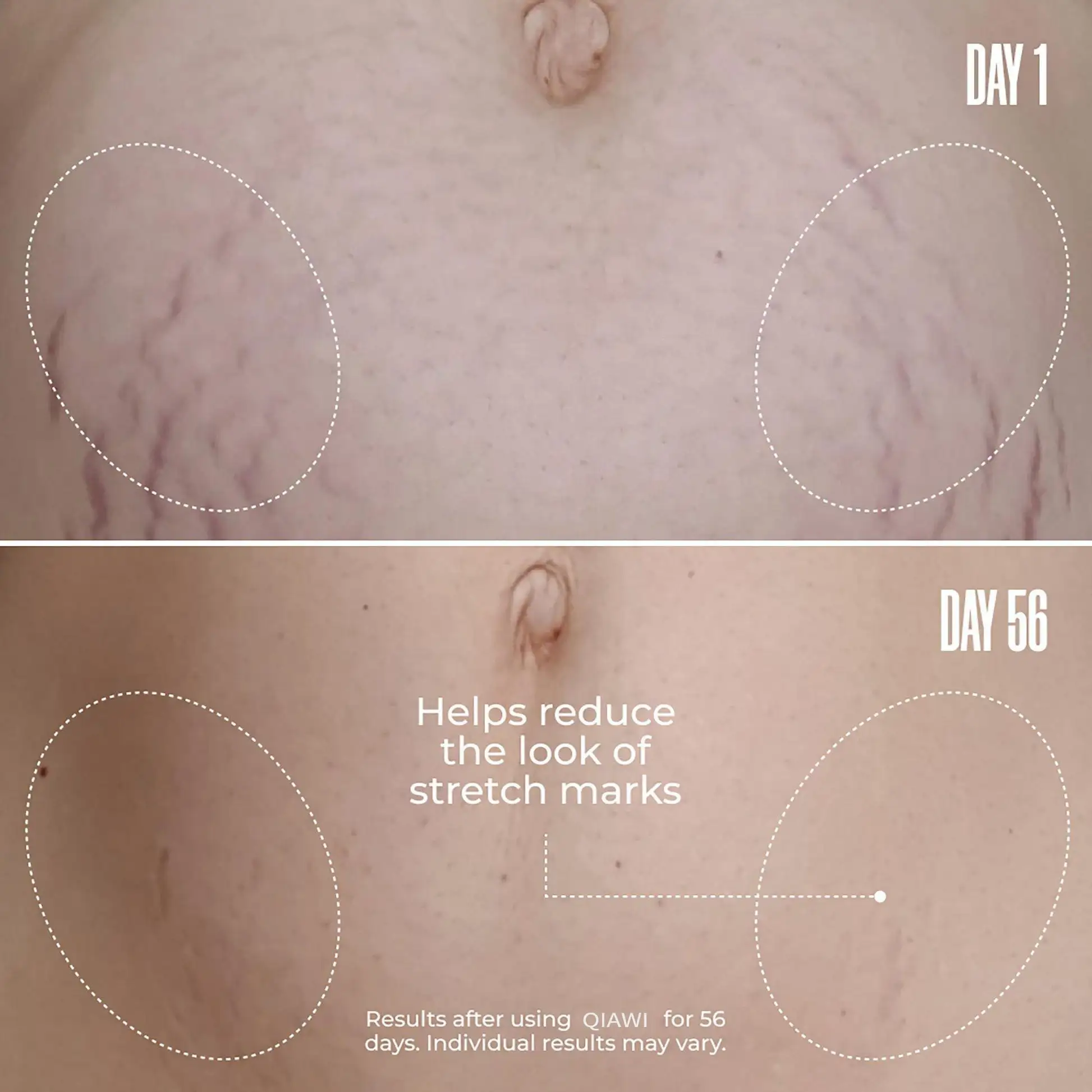 Tighten & Smooth Belly Cream - Image 7