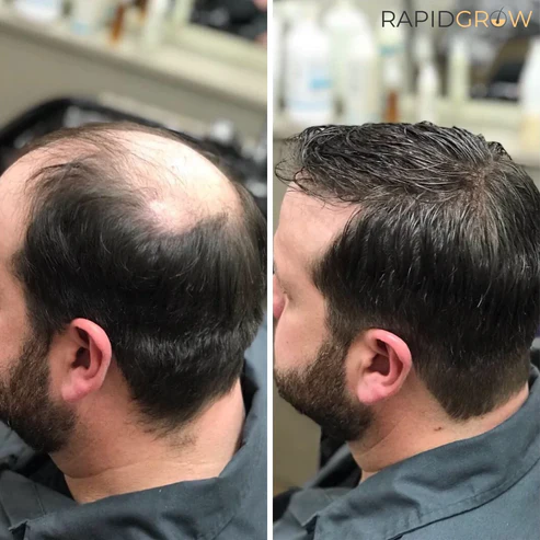 - Ginger Hair Growth Shampoo - Image 3