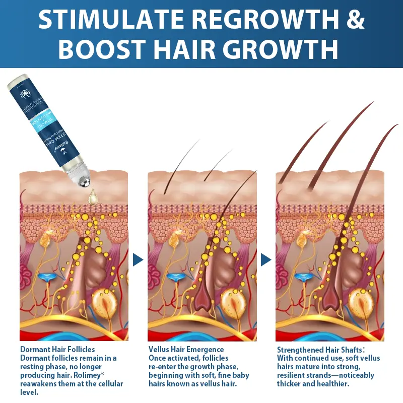 STEM Cell Hair Cycle Roller - Image 3