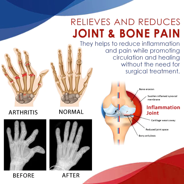 Joint and Bone Therapy Gel - Image 7