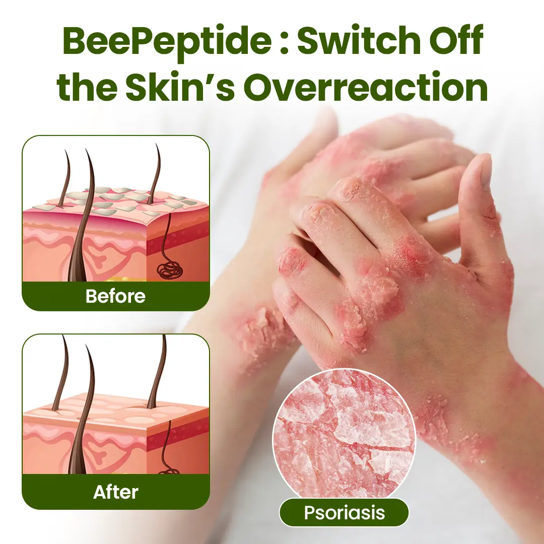 BeePeptide RootSoft DualRelief Cream - Image 2