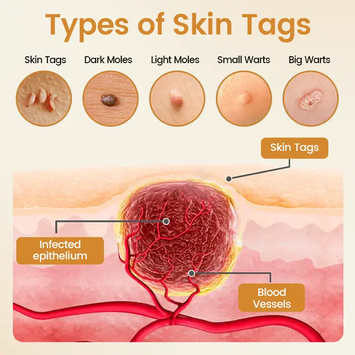 BeeVenom Wart Renewal Spray - Image 3