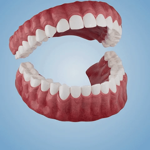 Advanced Customized Full Denture Set - Image 3