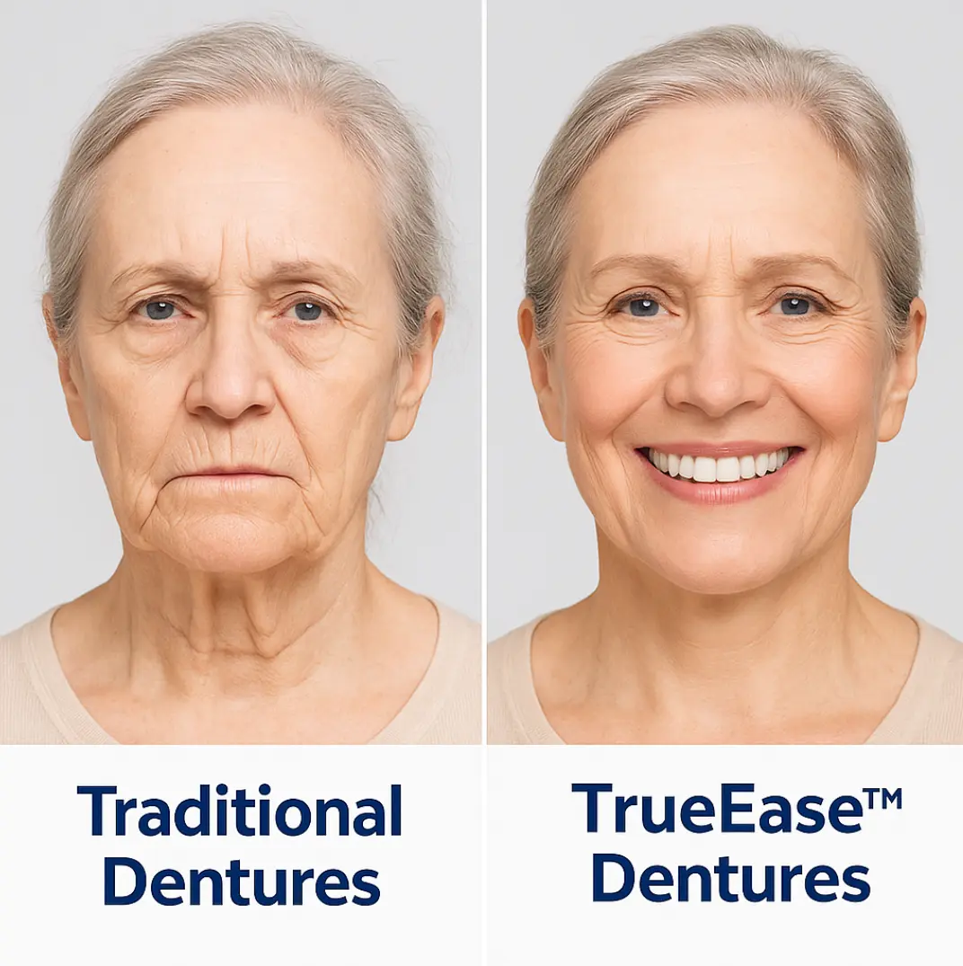 Custom-Fit Functional Dentures – Full Set - Image 4