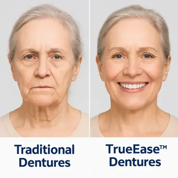 Truease Dentures - Image 5