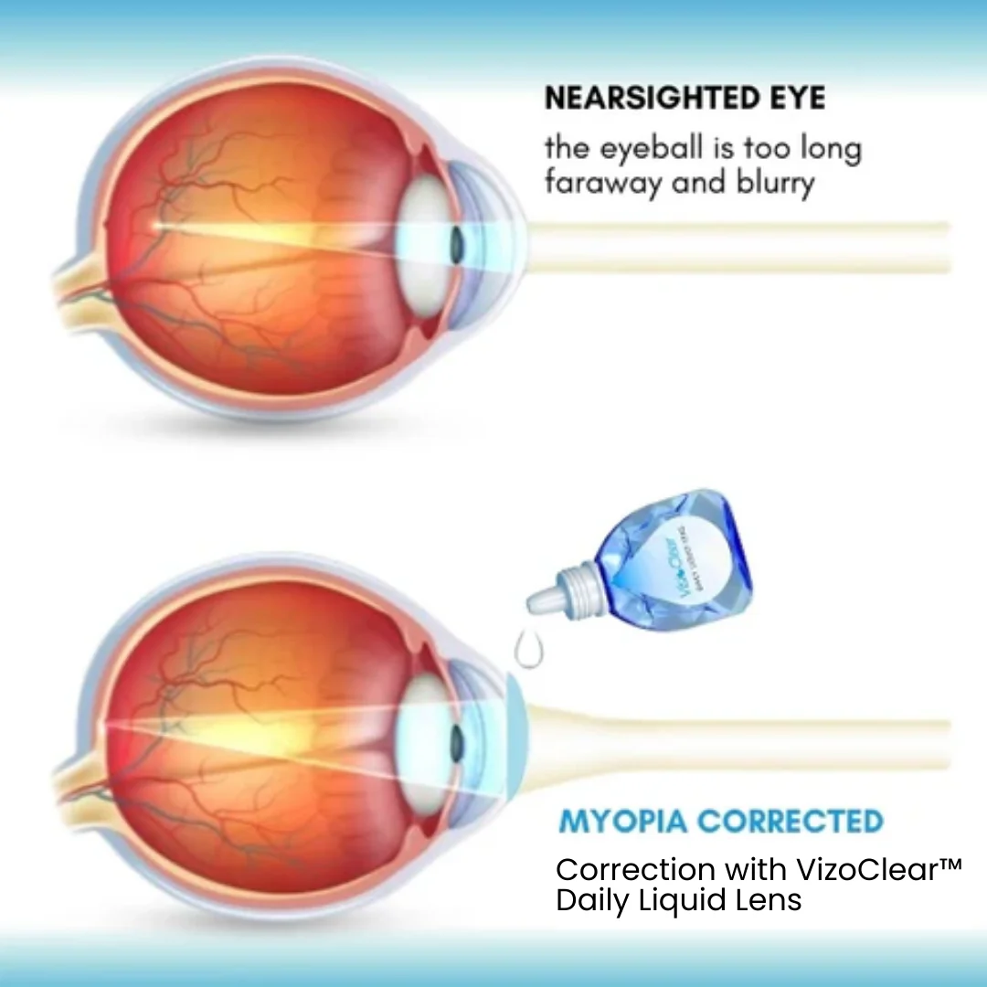 Daily Liquid Lens - Image 7