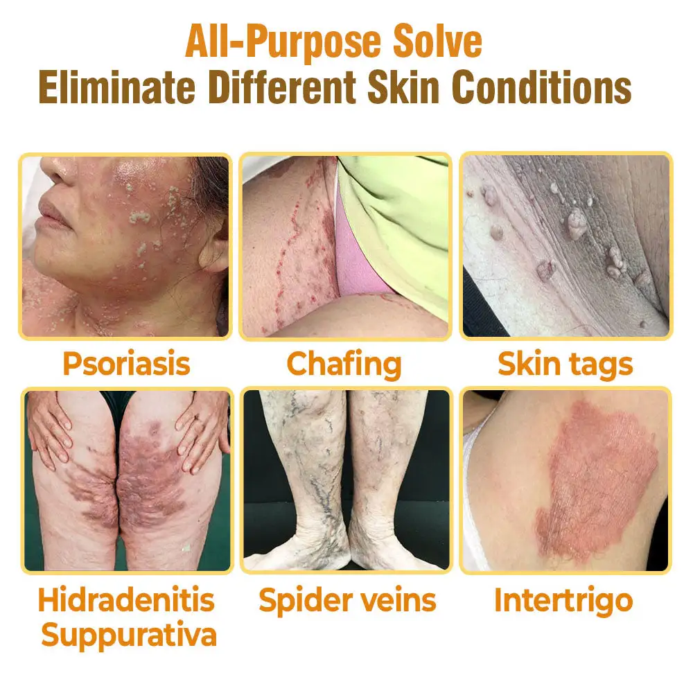 Bee Venom Comprehensive Cream - Image 2