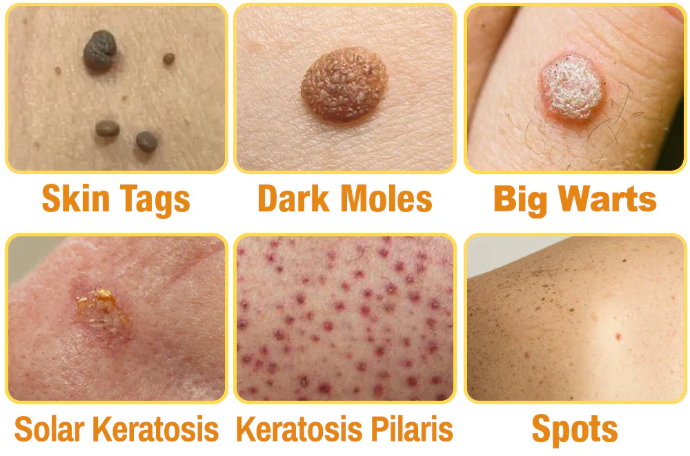 𝑩𝒆𝒆 𝑽𝒆𝒏𝒐𝒎 𝑴𝒐𝒍𝒆 𝒂𝒏𝒅 𝑾𝒂𝒓𝒕 𝑻𝒓𝒆𝒂𝒕𝒎𝒆𝒏𝒕 𝑶𝒊𝒏𝒕𝒎𝒆𝒏𝒕 - Image 10