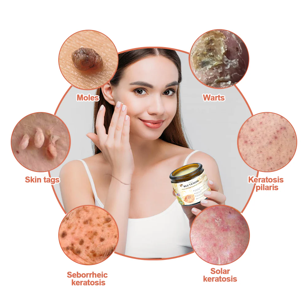 𝑩𝒆𝒆 𝑽𝒆𝒏𝒐𝒎 𝑴𝒐𝒍𝒆 𝒂𝒏𝒅 𝑾𝒂𝒓𝒕 𝑻𝒓𝒆𝒂𝒕𝒎𝒆𝒏𝒕 𝑶𝒊𝒏𝒕𝒎𝒆𝒏𝒕 - Image 5