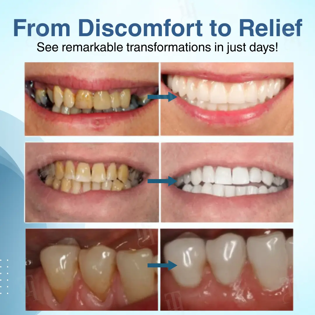 Dental Pulp Repair & Regeneration - Image 2