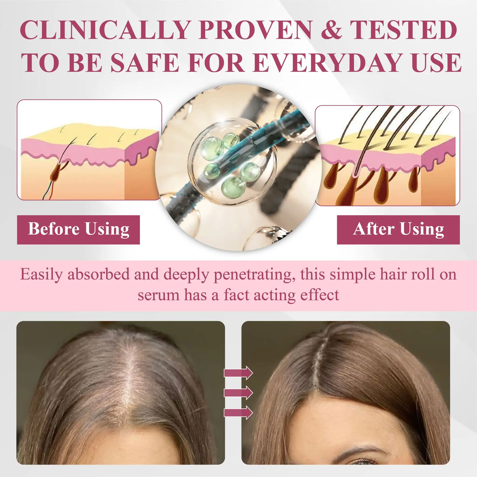 Hair Reawaken PP405 Roll-On Serum for Women - Image 5