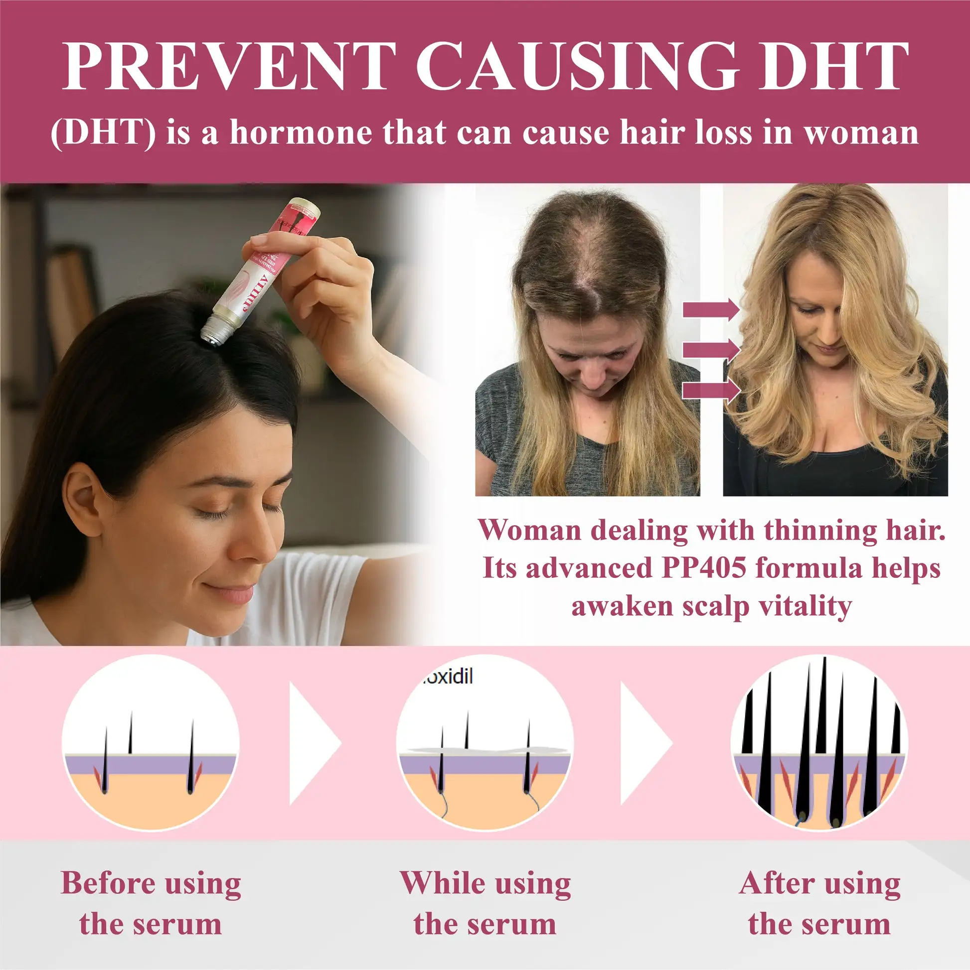 Hair Reawaken PP405 Roll-On Serum for Women - Image 7