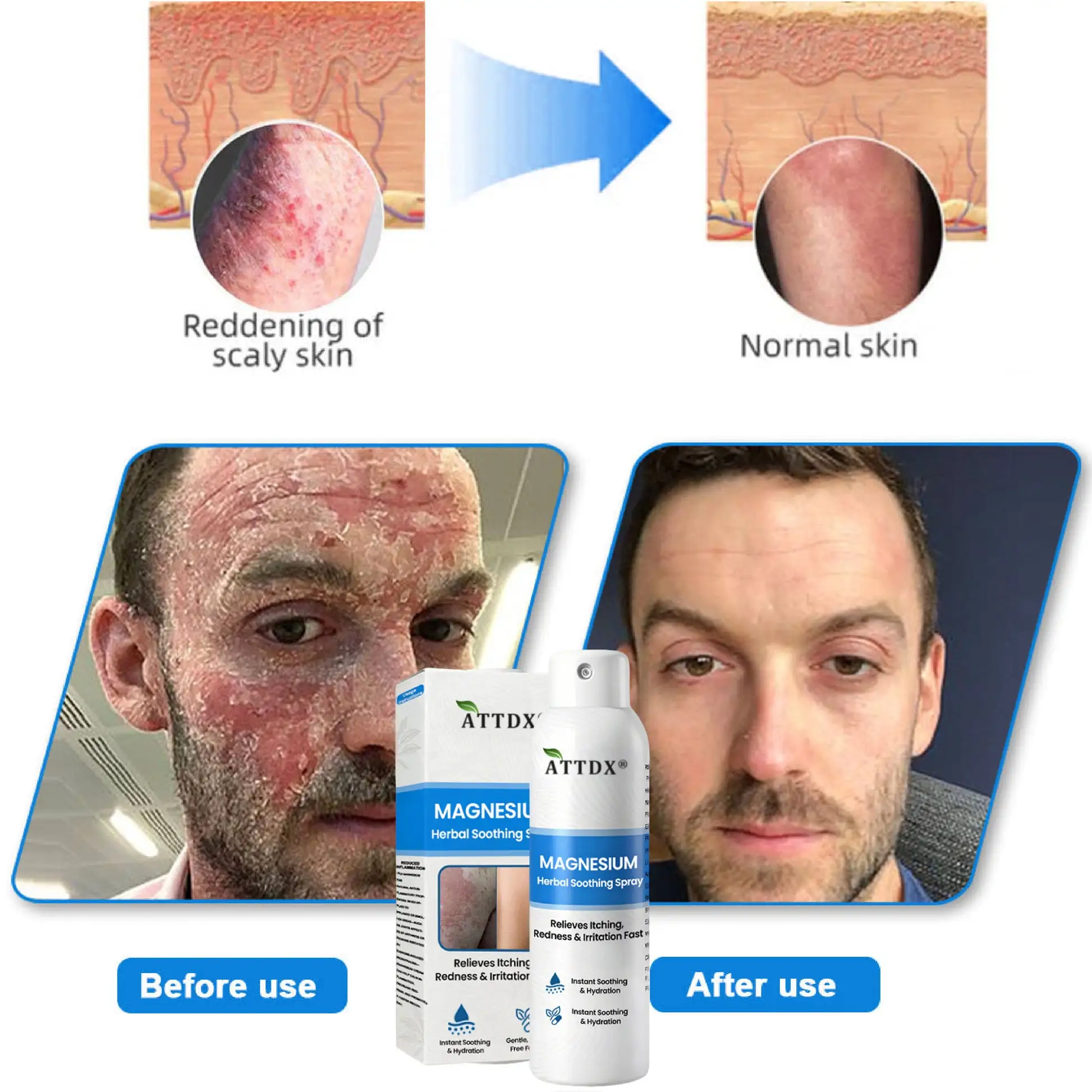 Magnesium Herbal Soothing Spray - Image 13