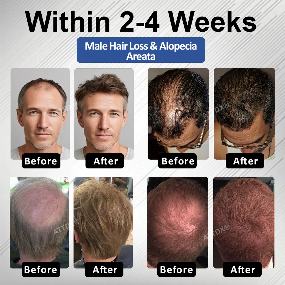 PP405 FolliGen Re-Awaken Hair Spray - Image 2