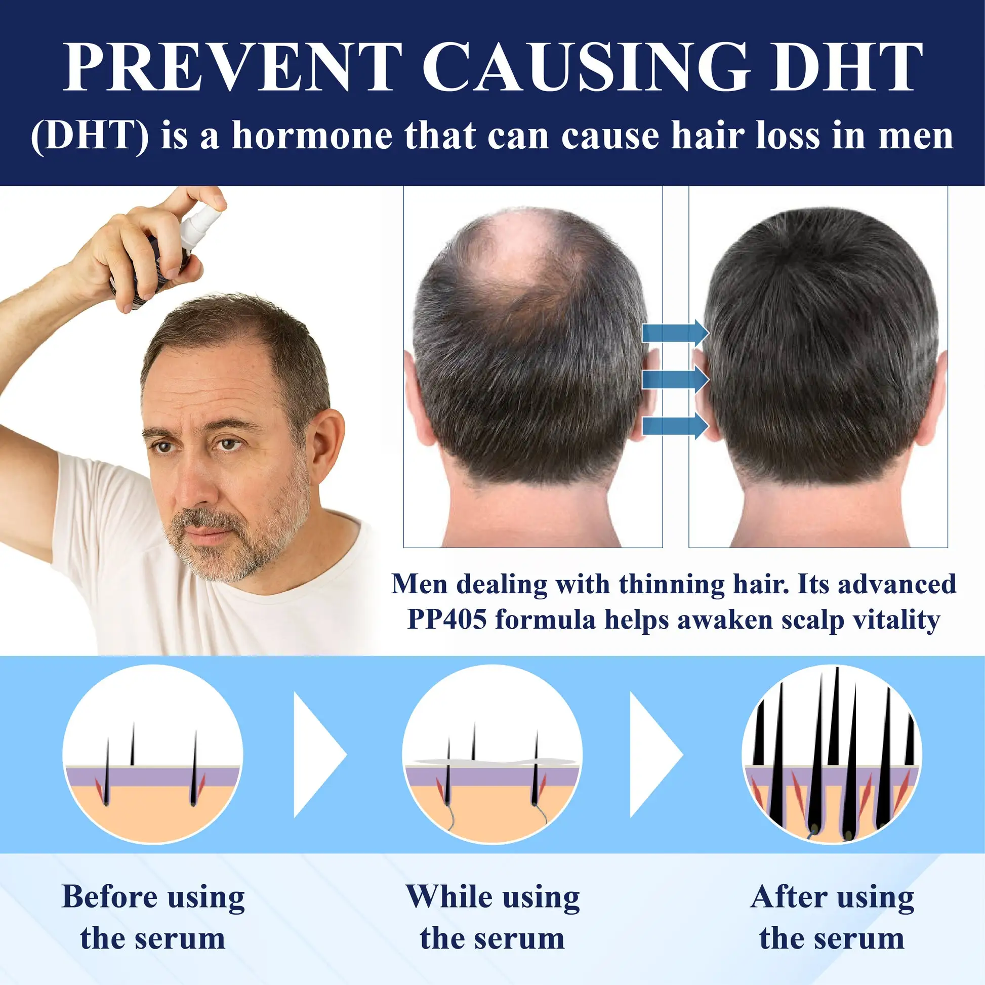 PP405 FolliGen Re-Awaken Hair Spray - Image 6