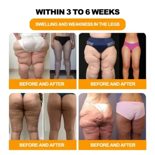 30-Herb Slimming & Detox Foot - Image 4