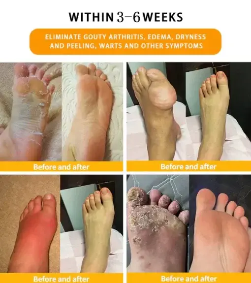 30-Herb Slimming & Detox Foot - Image 7