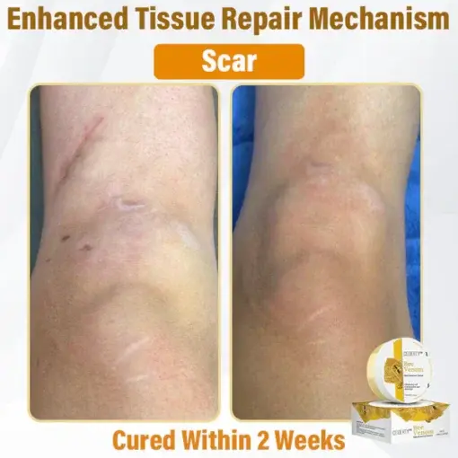 Bee Venom Skin Renewal Cream - Image 6