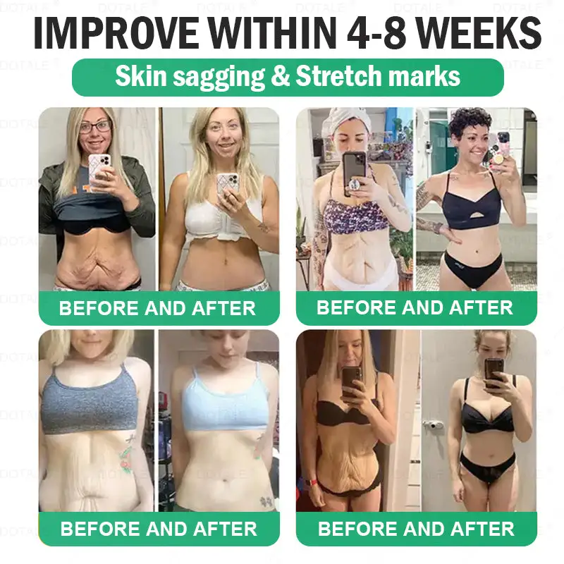 ๐ต๐จ๐ซ+ ๐ด๐๐๐๐๐๐ ๐ฉ๐๐๐๐๐๐๐๐ ๐จ๐ด๐ท๐ฒ ๐บ๐๐๐๐๐๐ ๐ต๐๐๐ ๐ด๐๐๐๐๐๐๐๐
๐๐ ๐ท๐๐๐๐ - Image 6