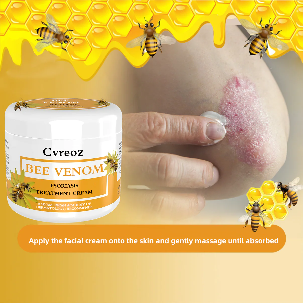 Cvreoz Bee Venom Psoriasis Treatmen - Image 5