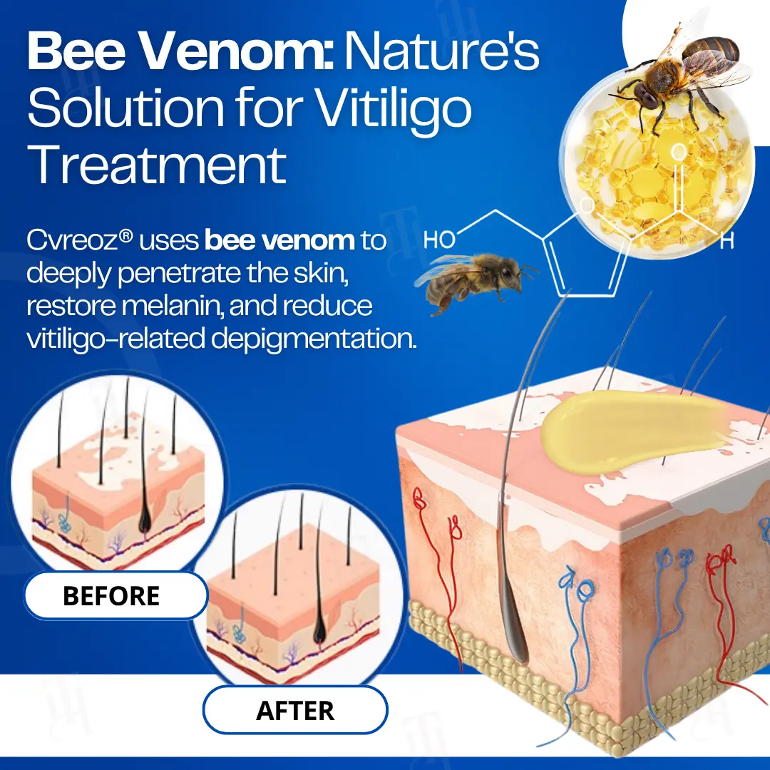 VitiClear Bee Venom Cream - Image 5