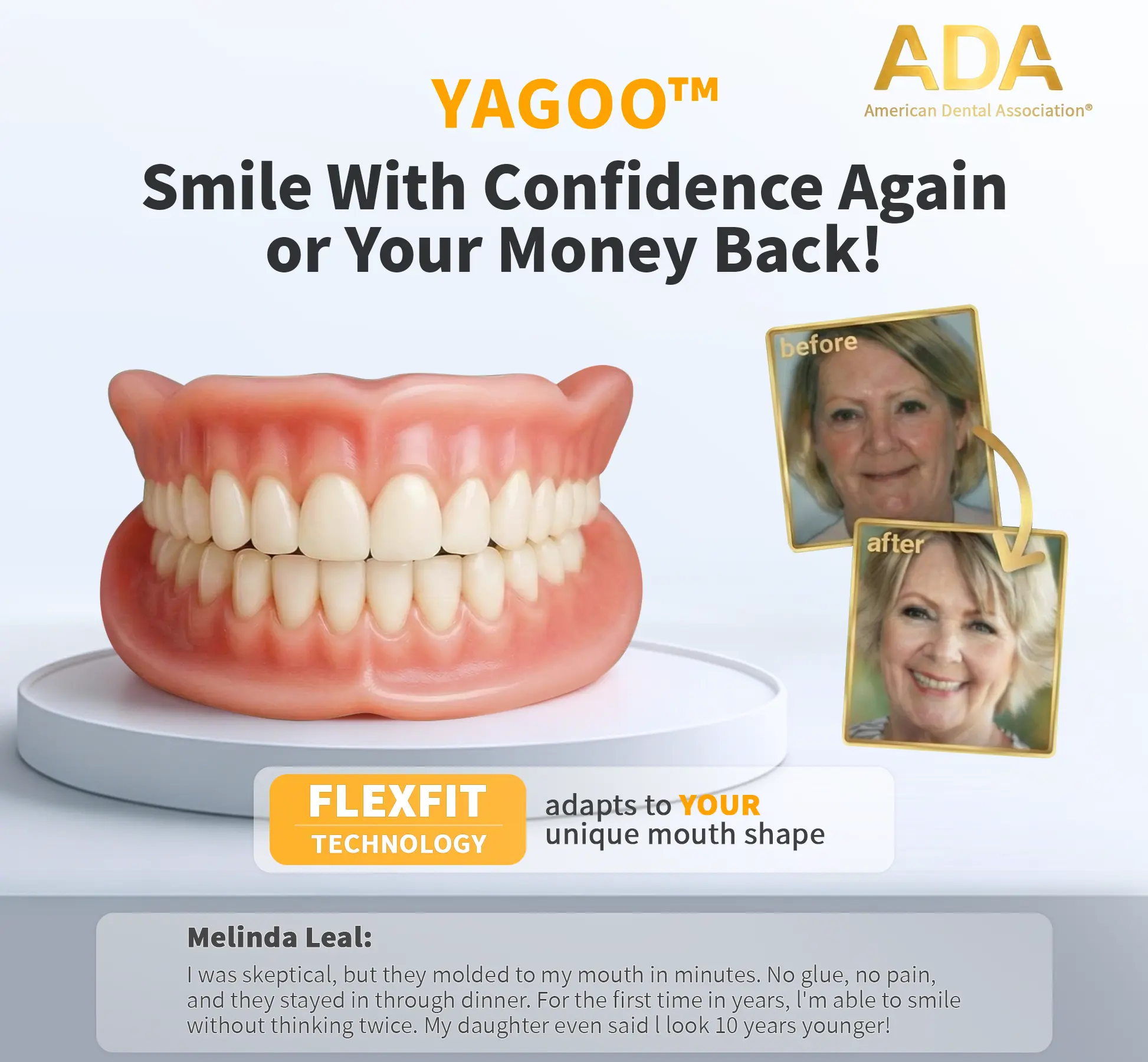 Custom-Fit Full Functional Dentures - Image 3