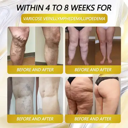 Oral Solution - Image 6