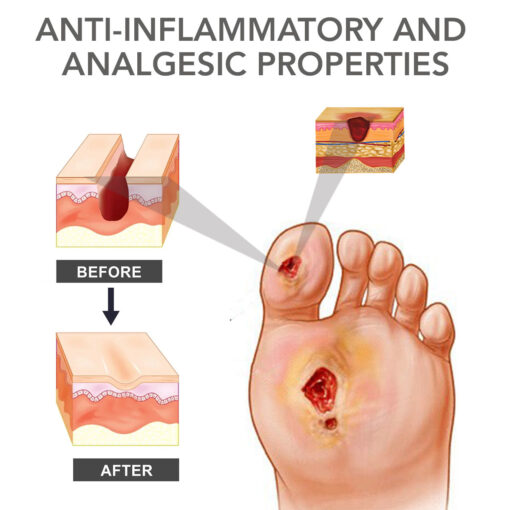 Fast Diabetic Wounds Healing Spray - Image 7