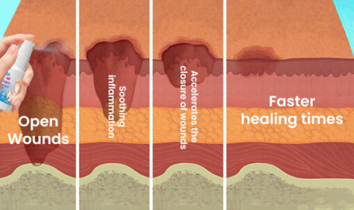 Fast Diabetic Wounds Healing Spray - Image 8
