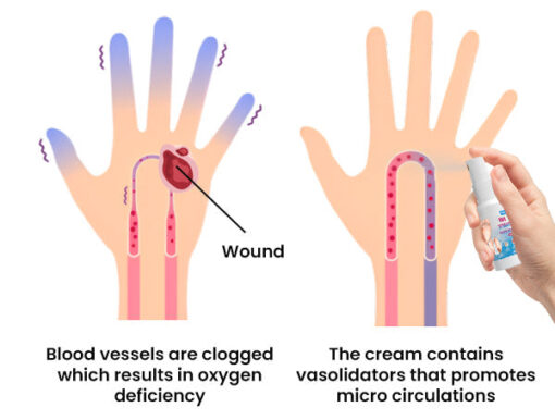 Fast Diabetic Wounds Healing Spray - Image 9