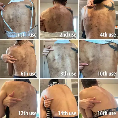 Melanin Correcting Facial Serum - Image 7