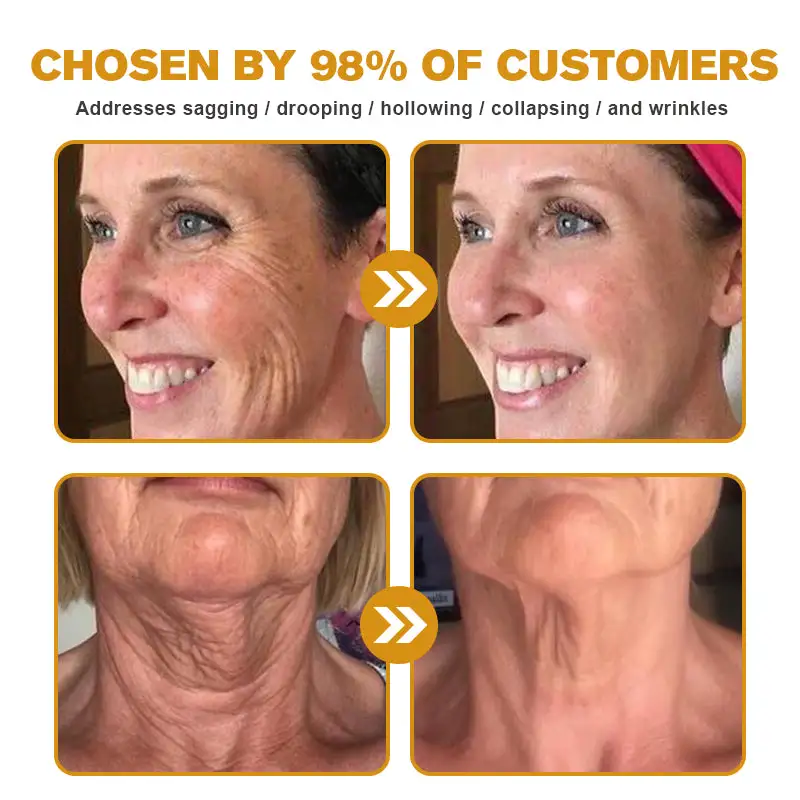 Botox Bee Venom Wrinkle Removal Cream-Last Day Promotion 80% OFF - Image 6