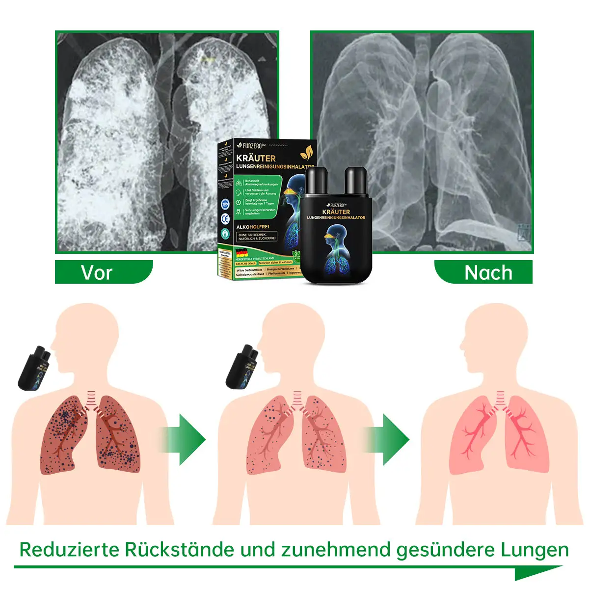 Kräuter-Lungenreinigungsinhalator - Image 6