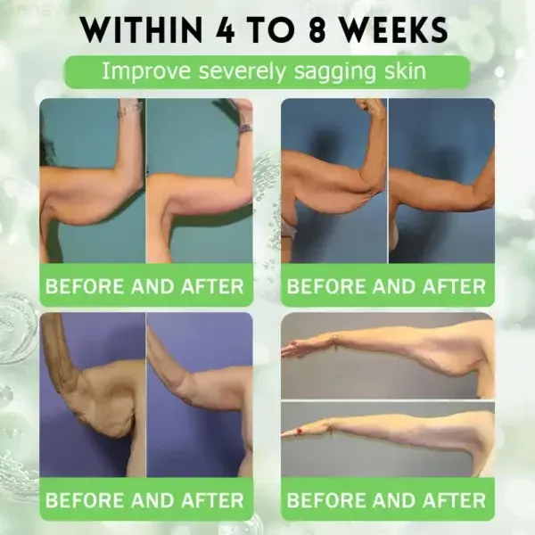 ️ MORINGA+BERBERINE Advenaced Nano Microneedle Patch - Image 6