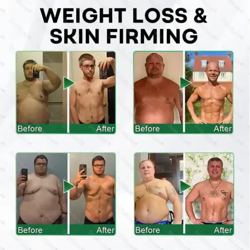 7-Day Herbal Nanoneedle Shaping Patch - Image 7