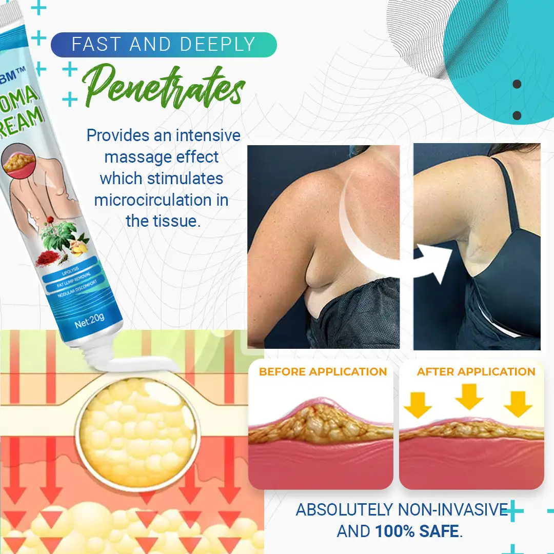 Lipoma Removal Cream - Image 4