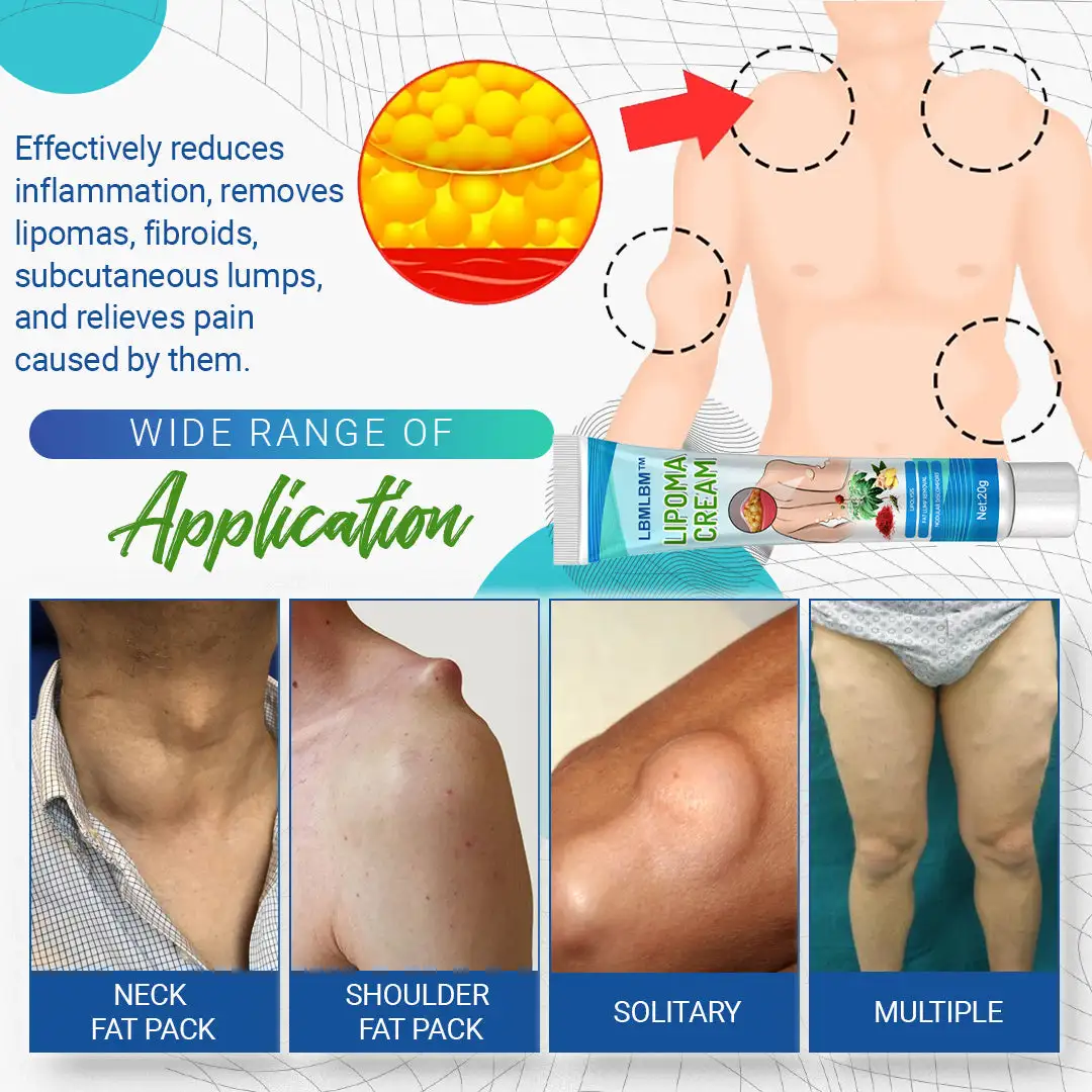 Lipoma Removal Cream - Image 7