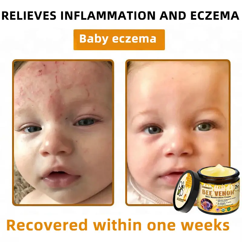Bee Venom Skin Restoration Cream - Image 6