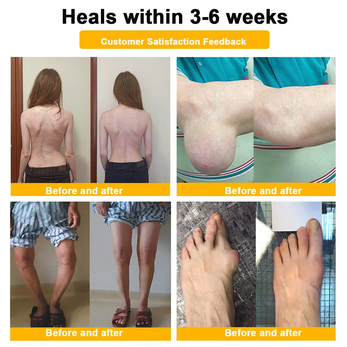 Botulinum Toxin & Bee Venom Pain-Relief Bone Healing Cream - Image 13