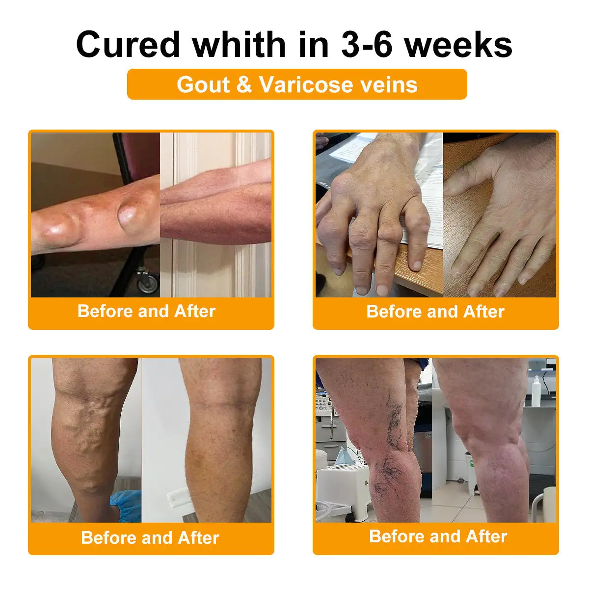 Botulinum Toxin & Bee Venom Pain-Relief Bone Healing Cream - Image 15