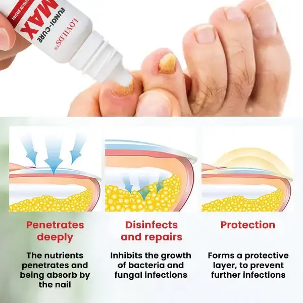 Fungi-Cure Max - Image 4