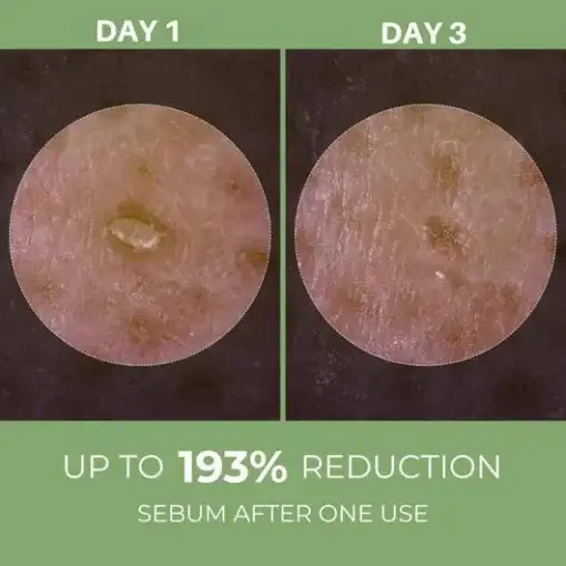 Rice Peel Ampoule - Image 2