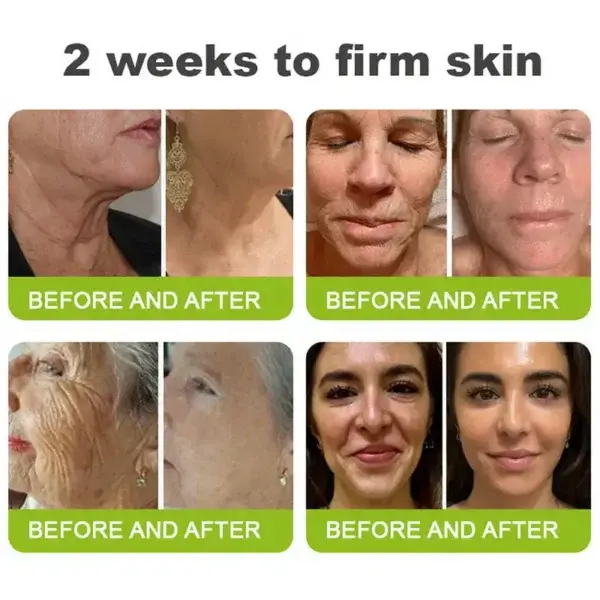 Skin Tightening & Vita-A Retinol Retinol shot Anti-Wrinkle Firming Tightening cream - Image 7