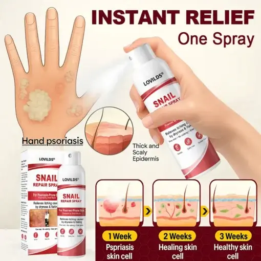 Snail Repair Spray for Itchy, Flaky Psoriasis Skin - Image 4