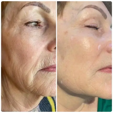 Water Light Anti-Aging Facial Cream - Image 5