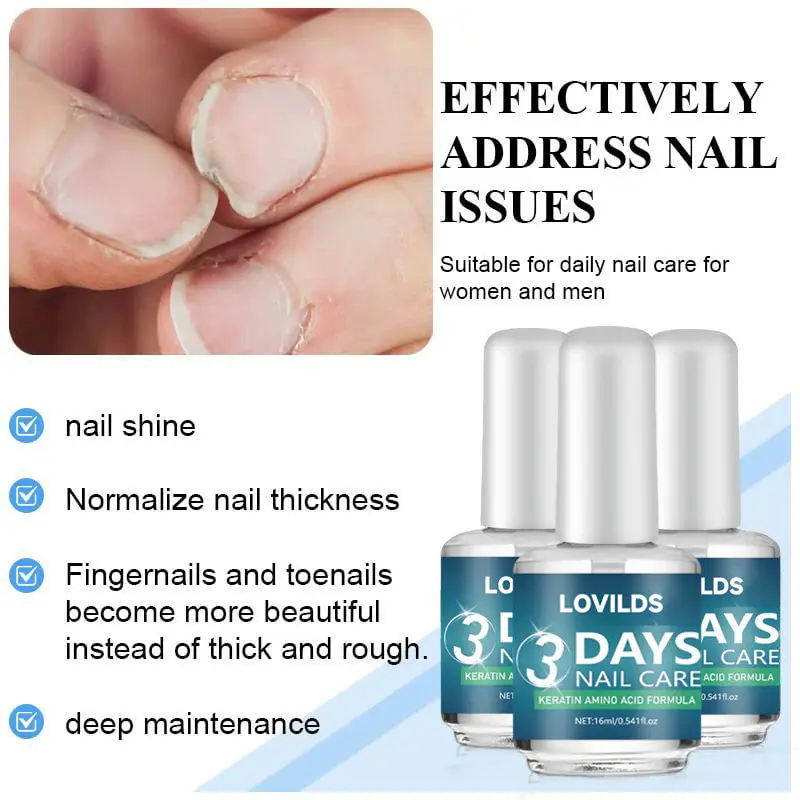 Last Day 50% 3 Days Nail Care Formula - Image 10