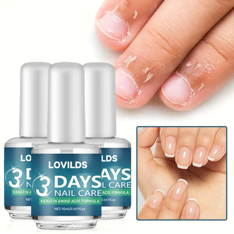 Last Day 50% 3 Days Nail Care Formula - Image 11