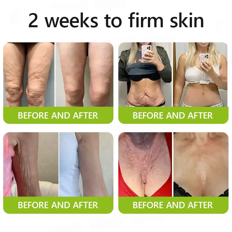 Botox & Retinol Shot - Image 6