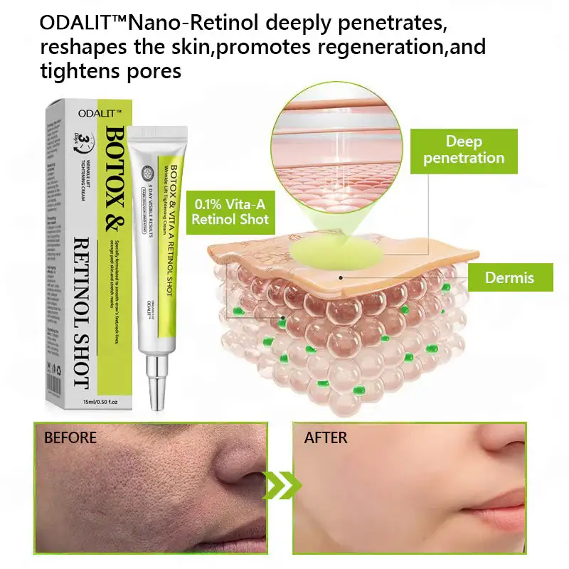 Botox & Retinol Shot - Image 9