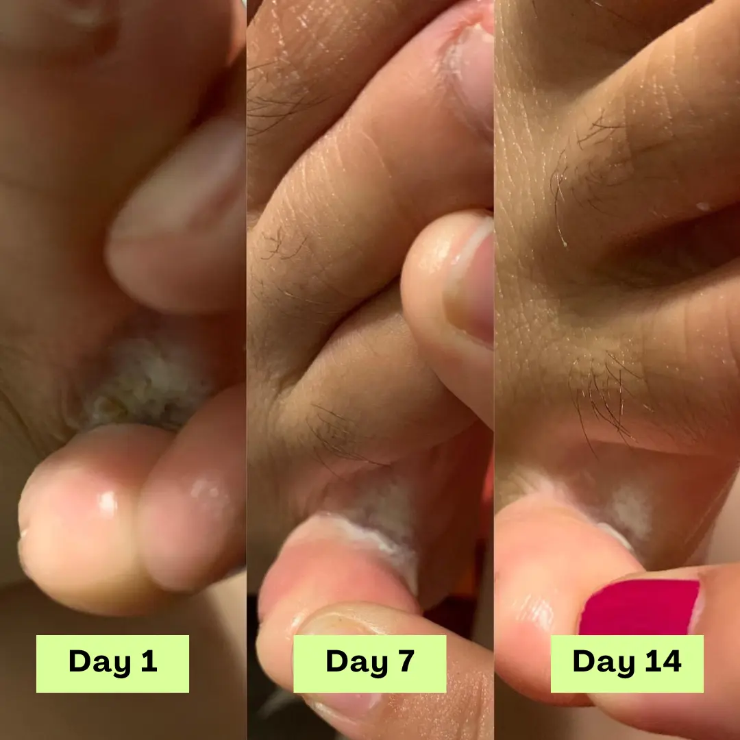 55% off AntiFungal Relief Soap Bar - Image 7